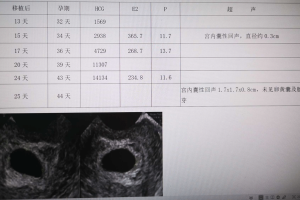 胚胎停育