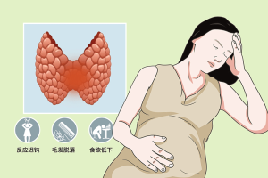 甲状腺功能低下