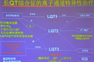 长QT间期综合征